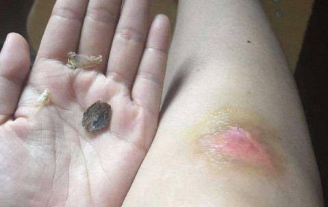 arr和grr是什么意思-开云网页版