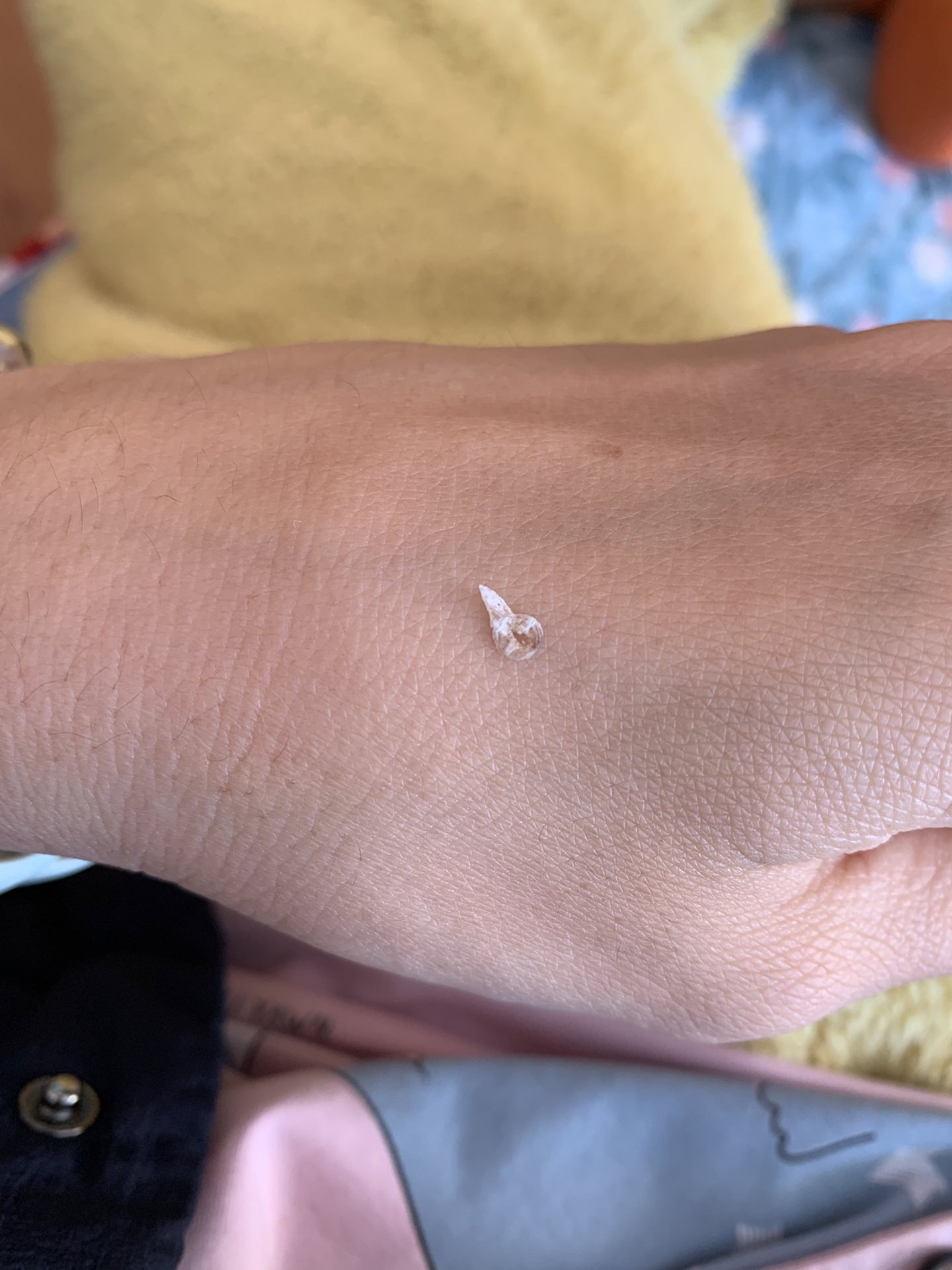 arr和grr是什么意思